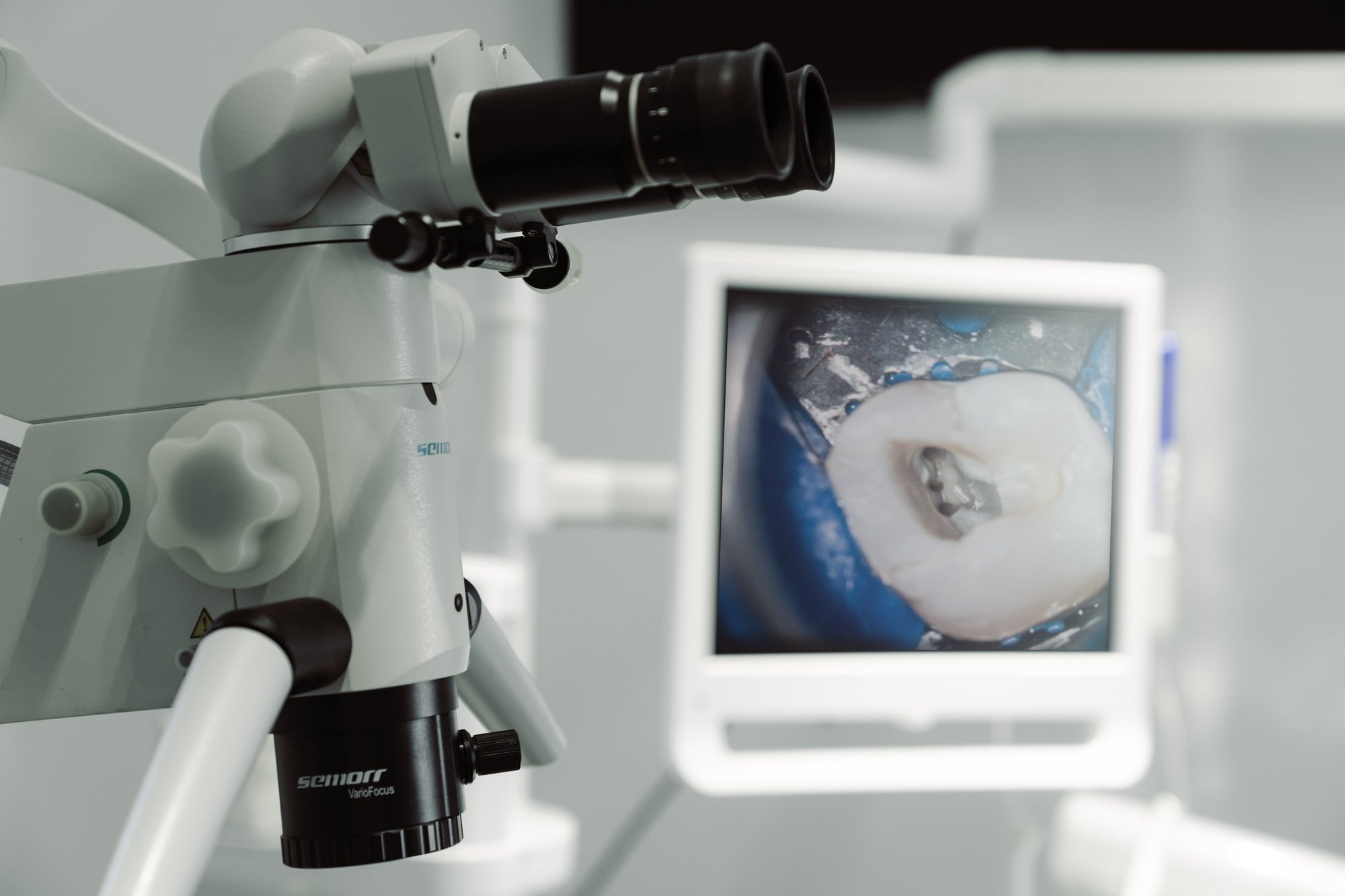 Microscop de endodonție cu imaginea dintelui pe ecran