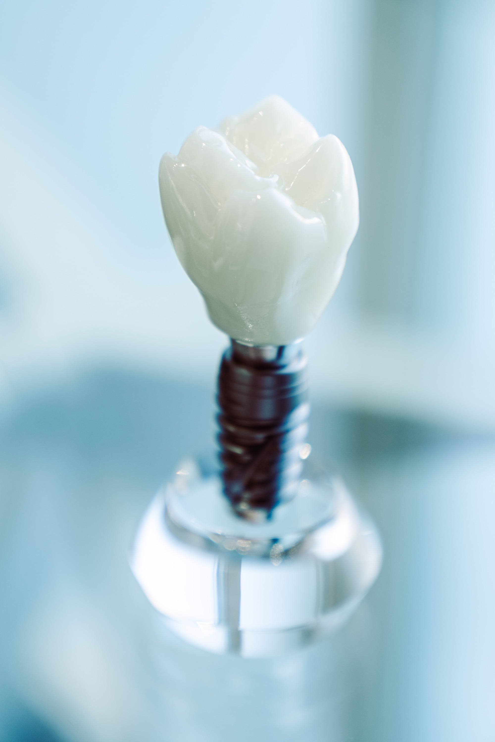 Chirurgie dentară